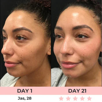 Eye therapy- eye care