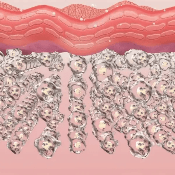 Eye therapy- eye care